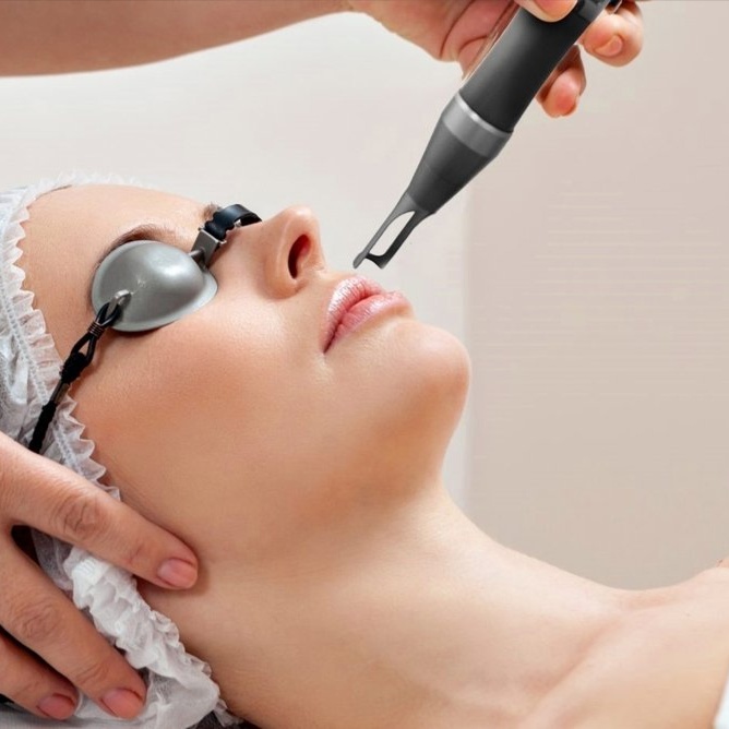 Laser Vein at Natural Vybe in Newport Beach, CA