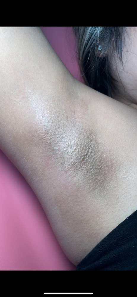 UNDERARM