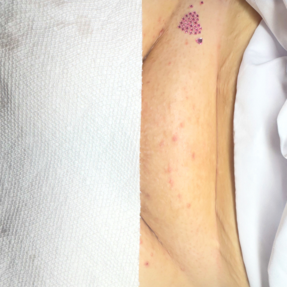 Vajacial/Intimate Brightening Addon at Blush & Bare Esthetics in Gresham, OR