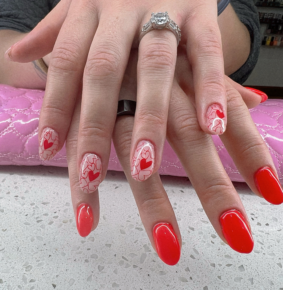 Gel Extension Backfill