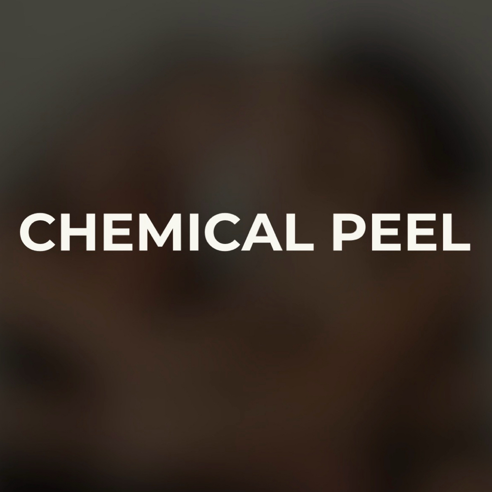 The VI Chemical Peel at Turtle Creek Aesthetics in Texas, TX