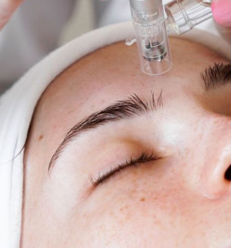 Nanoinfusion Facial-Infunsion Facia