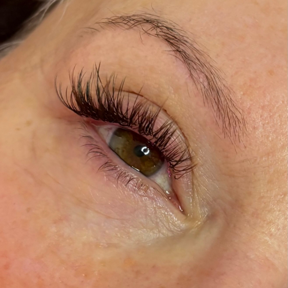 Classic 1 Week Fill at KateVEsthetics in Milton, DE