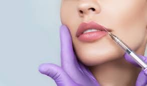 Dermal Filler-Lips