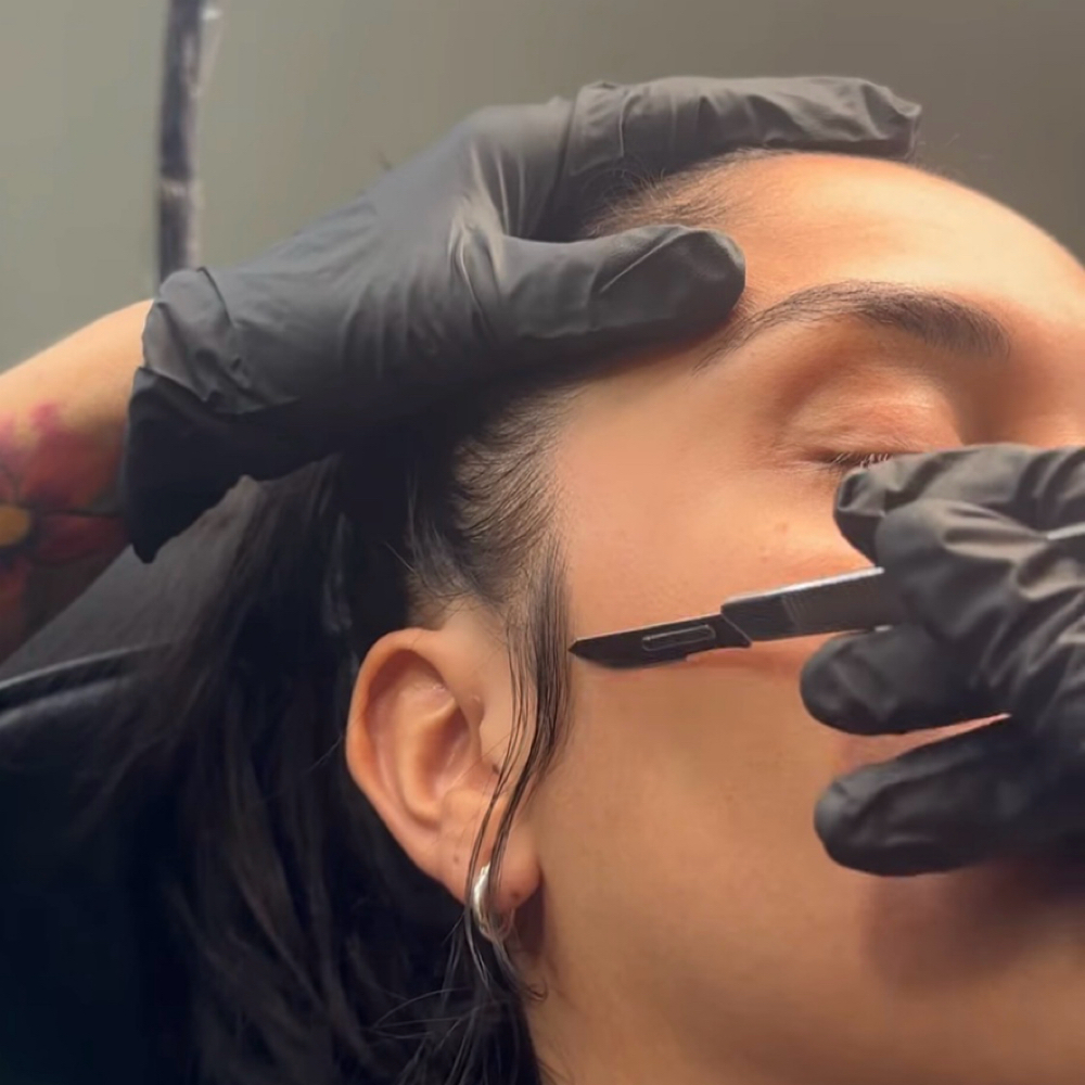 Dermaplaning at T&N Skin Med Spa Inc in Abington, PA