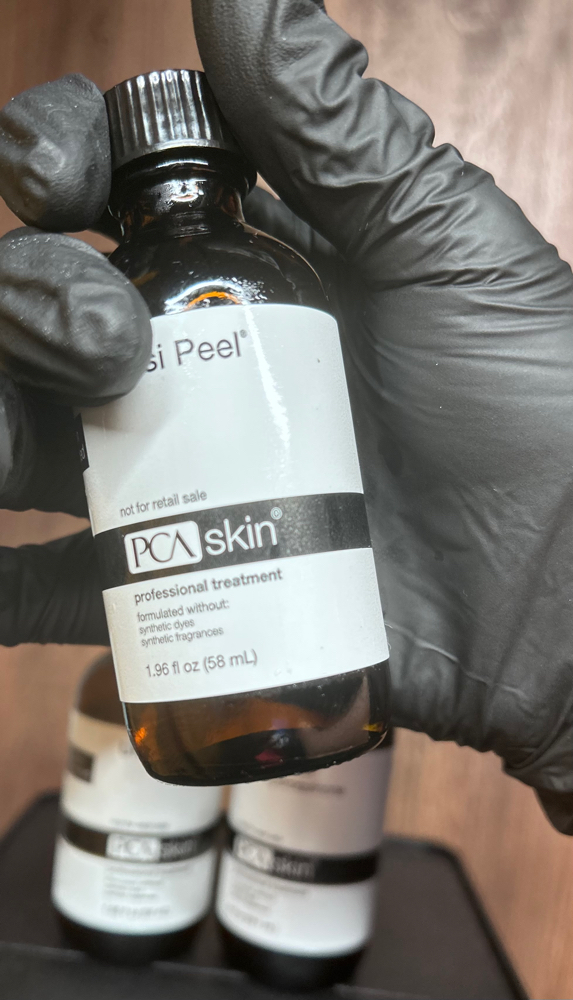 Chemical Peels