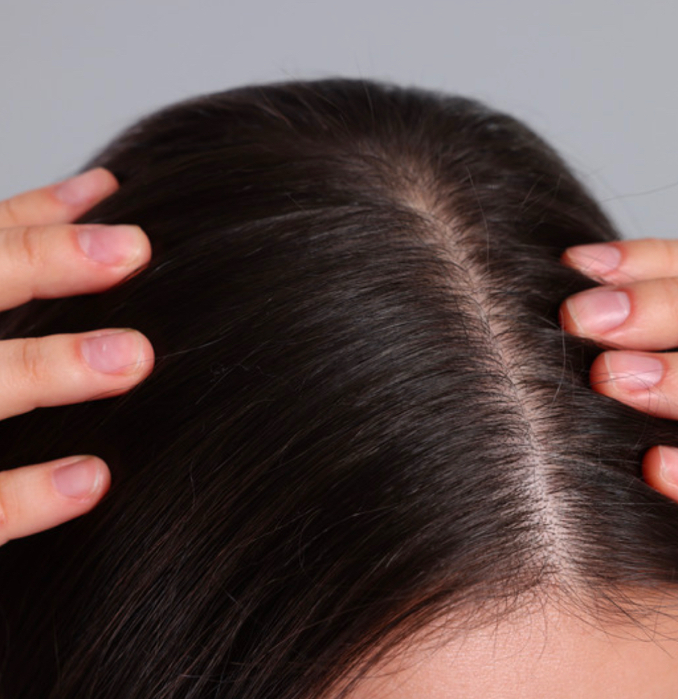 Scalp Synergy