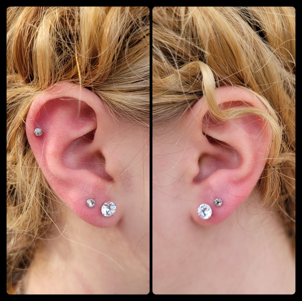 Double Ear Lobes (Both Ears)