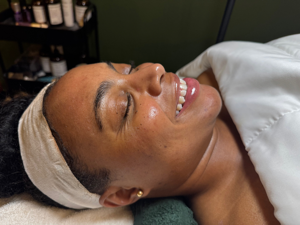 Microdermabrasion Facial