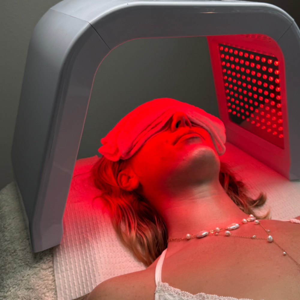 LED REJUVENATION at BYLISETTA in Vista, CA