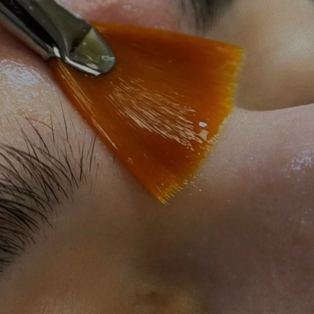 Obagi Blue Peel Radiance at Cox Clinic & Aesthetics in Antlers, OK