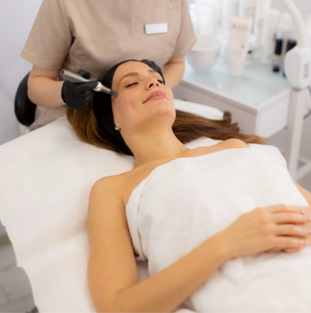 Microneedling at Benlux Aesthetics in Alexandria, VA