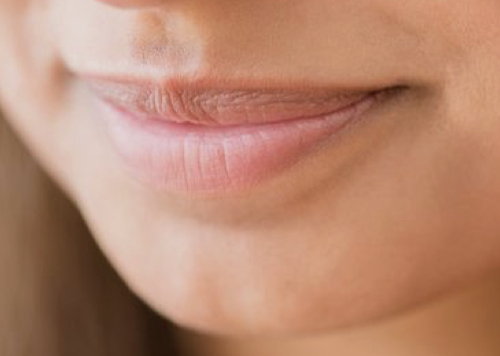 Wax Chin
