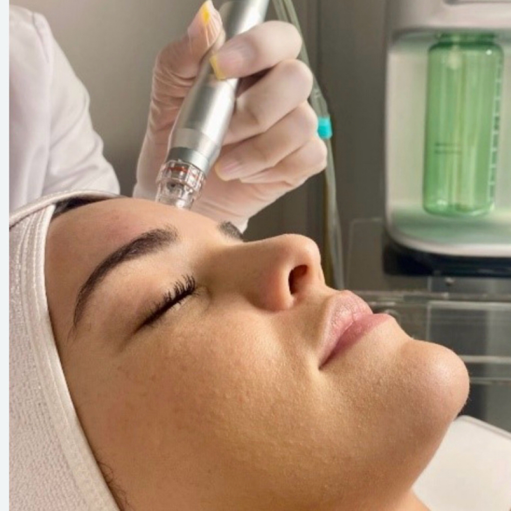 Hydro Facial With Oxygen Boost at Rejuvené Aesthetics & Wellness in Croton-on-Hudson, NY