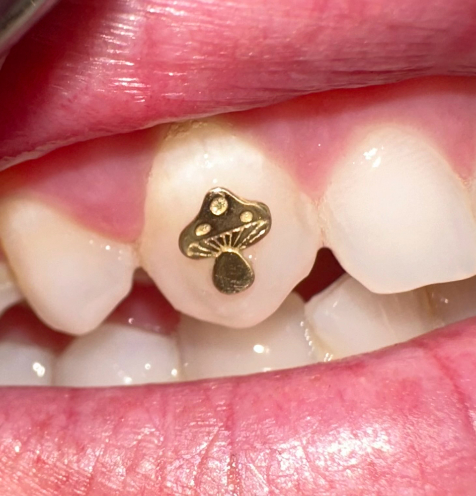 18k Gold Tooth Gem