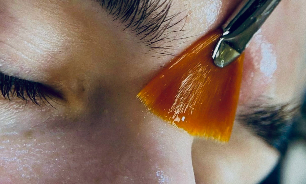 Lite Chemical Peel