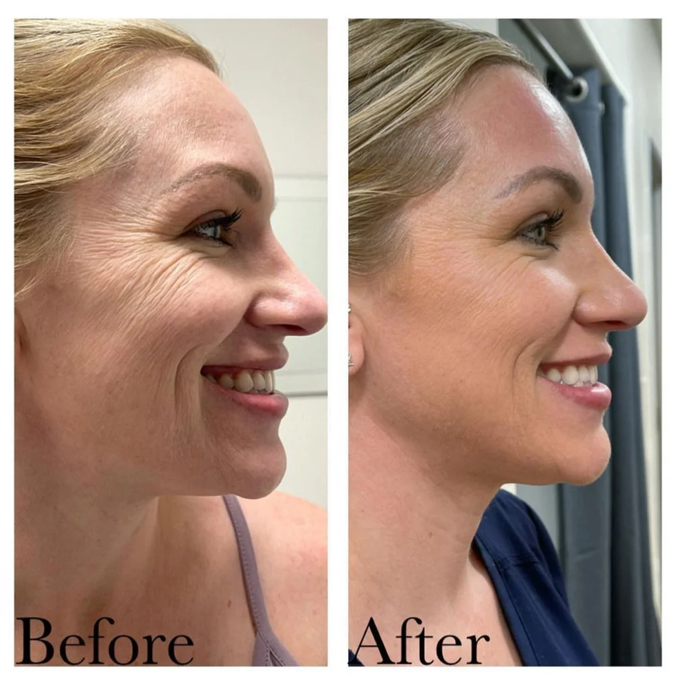 Neck & Décolleté Duo