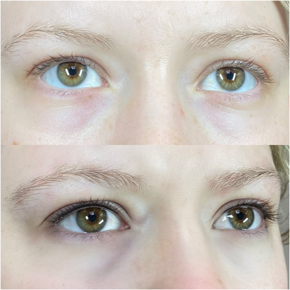 Lashline Enhancement