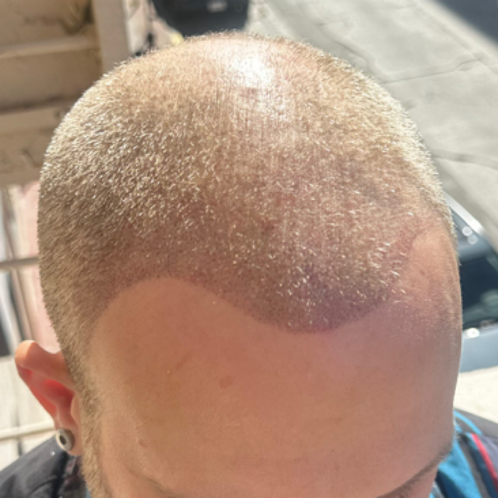 FREE Virtual SMP Consultation