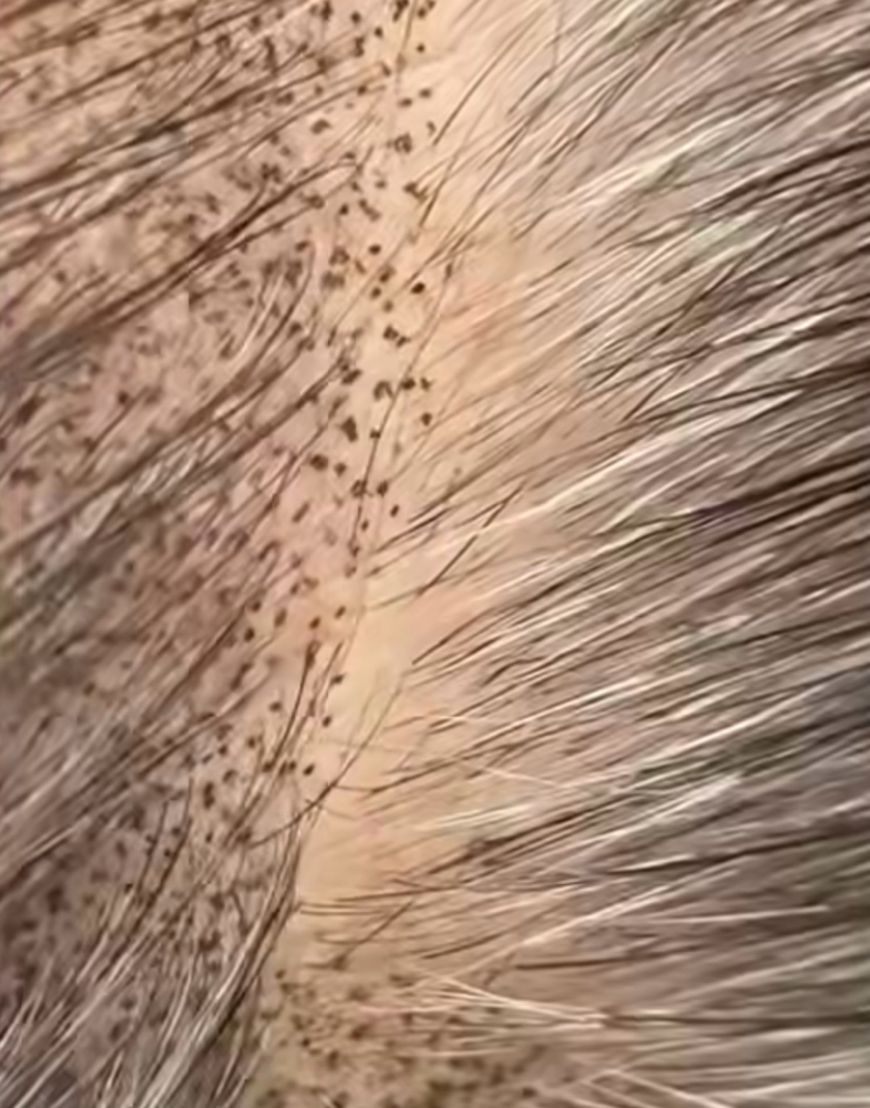 SMP 1/2 Head Shading/Powder at The Beauty Bar Ink in Huntsville, AL