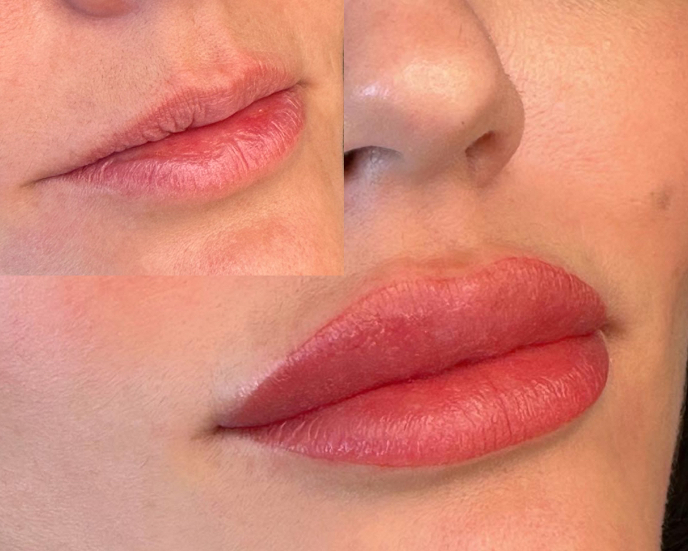 6-8 WEEK LIP FINE-TUNE