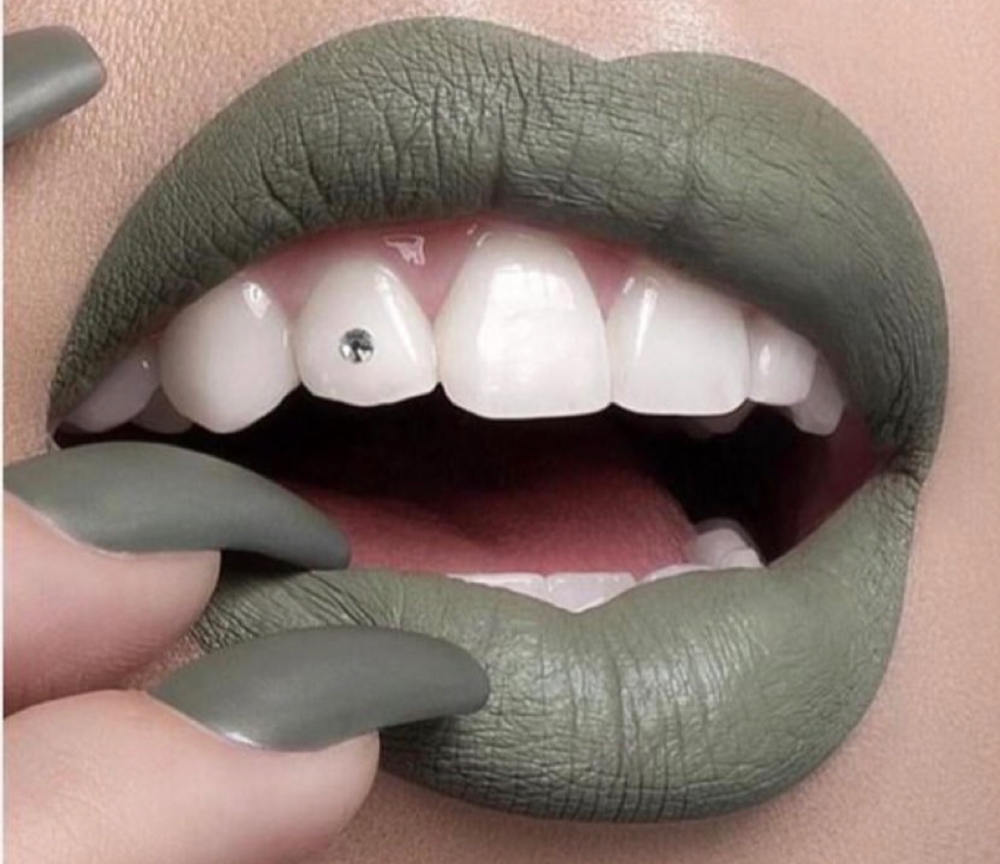 Tooth Gem