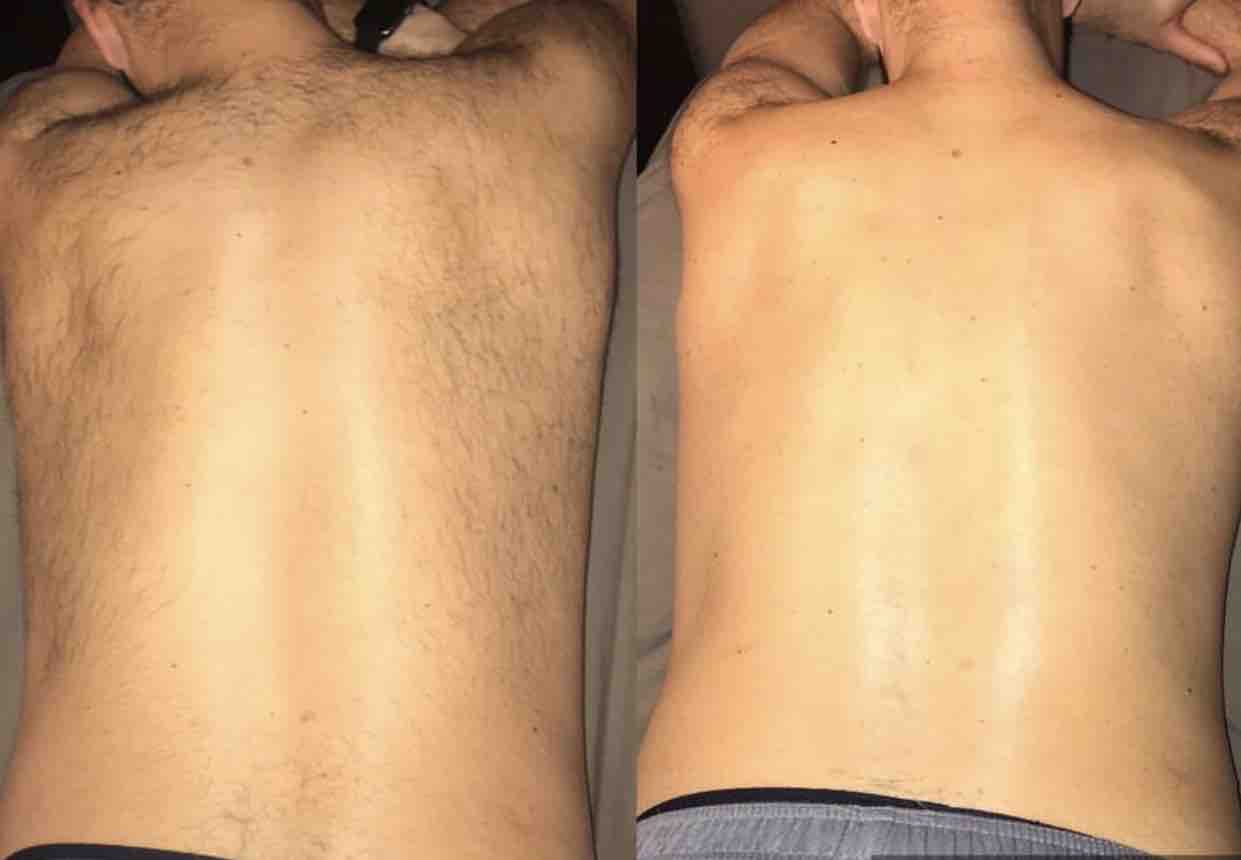 Back Wax