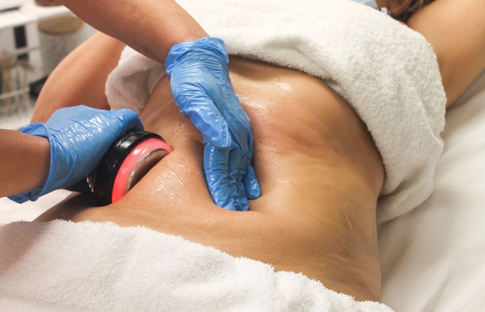 Cavitation