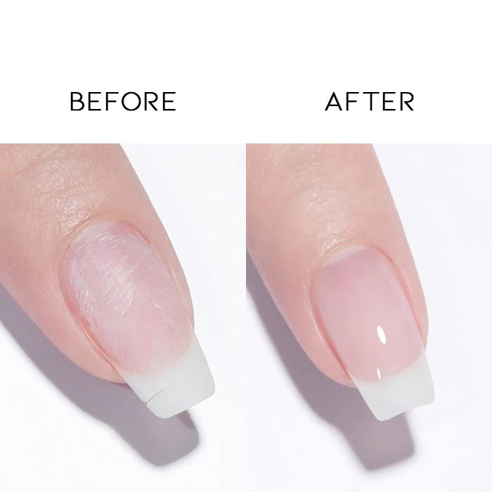 Nail Repair