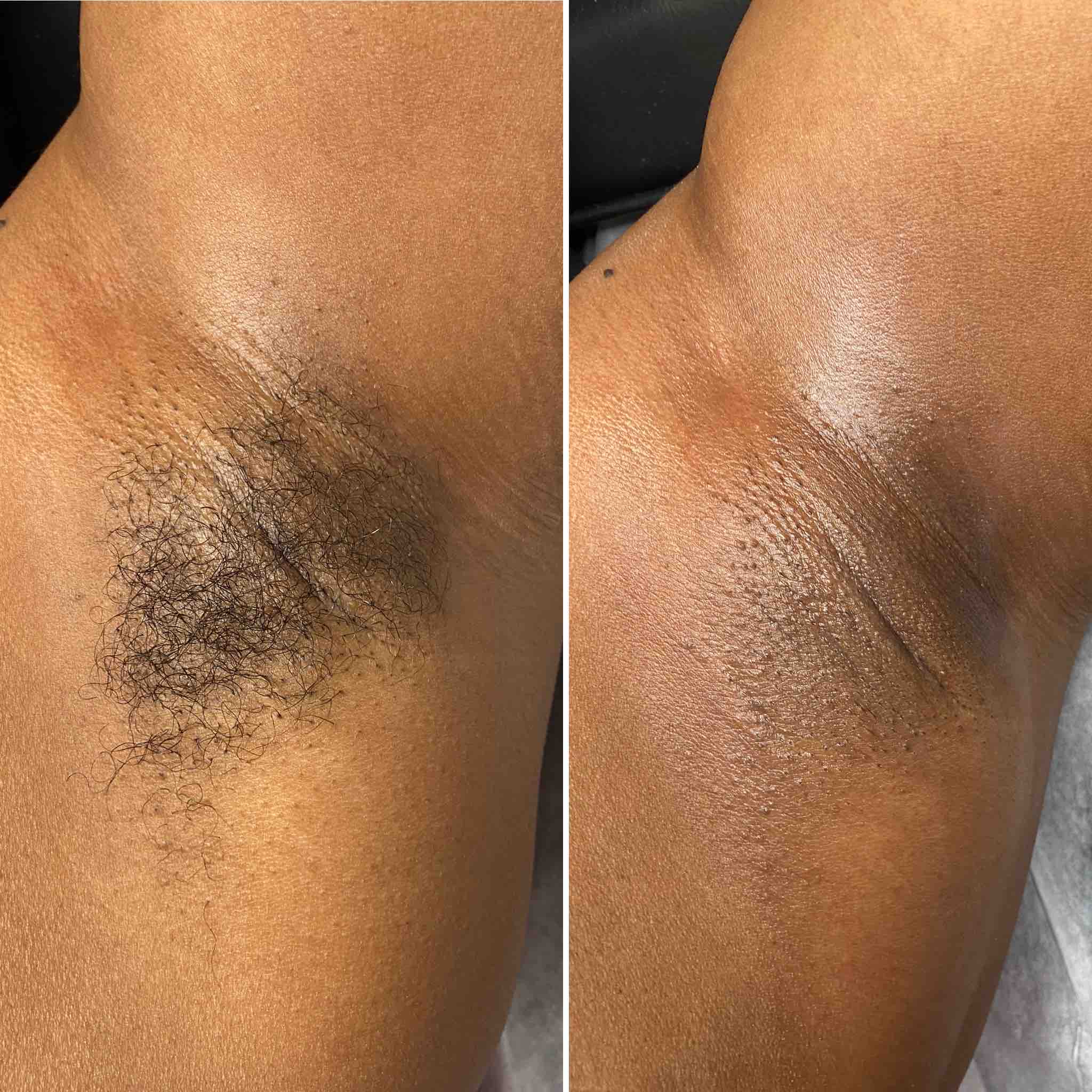 Underarm Wax