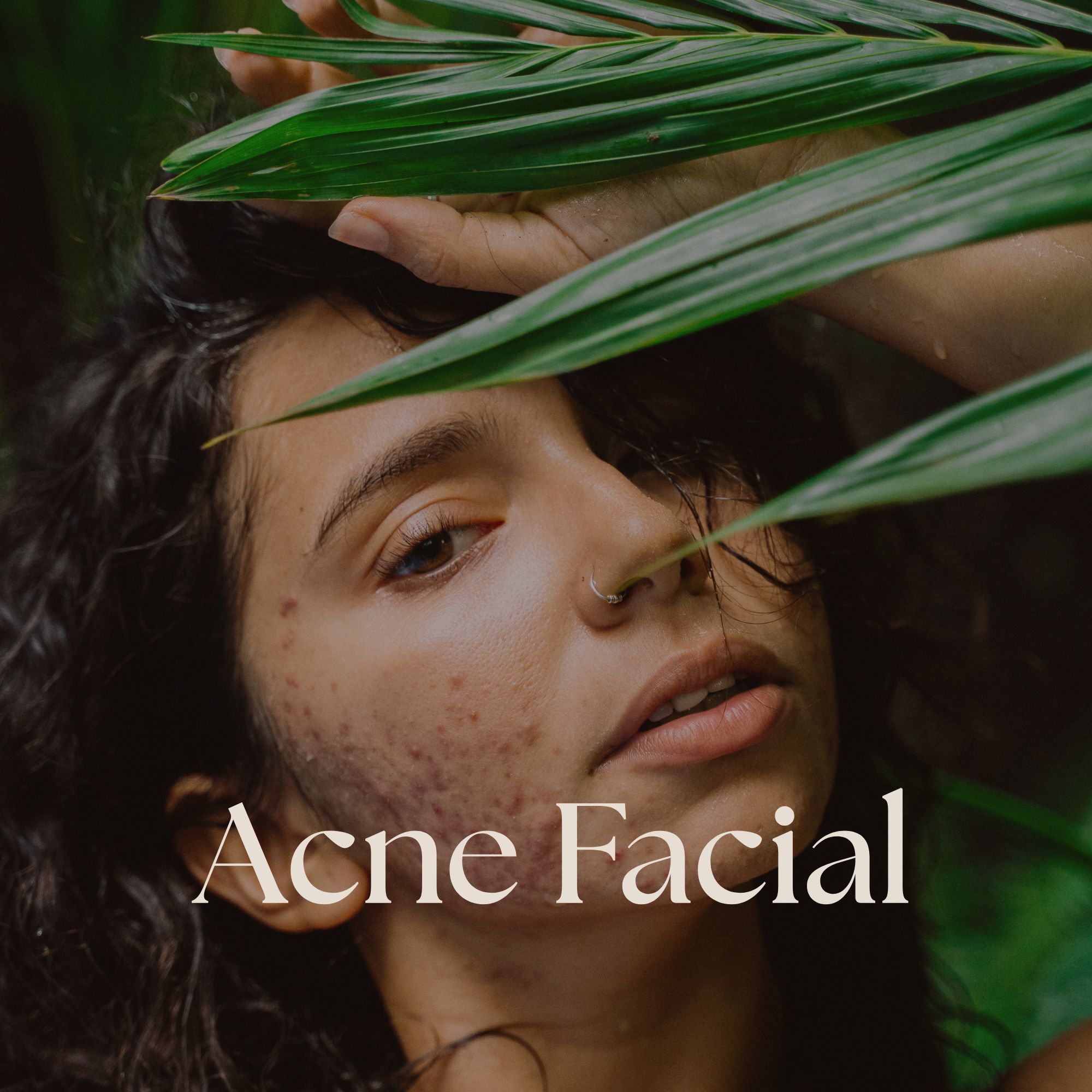 Acne Facial