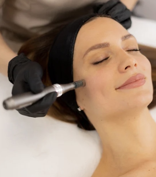 Microneedling Revitalize