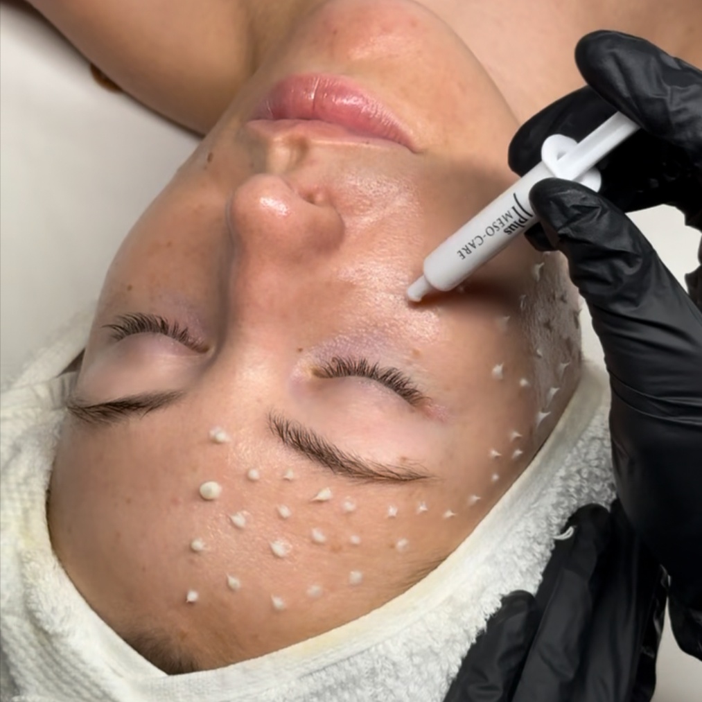 CellStory at JASMINE THE FACIALIST in Beverly Hills, CA