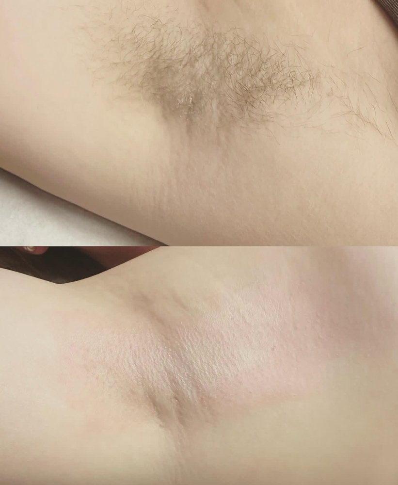 Underarm Wax