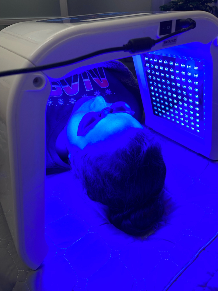 ADD ON: LED Skin Light Therapy