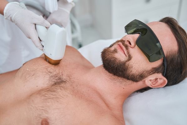 MEN : LASER FULL BODY