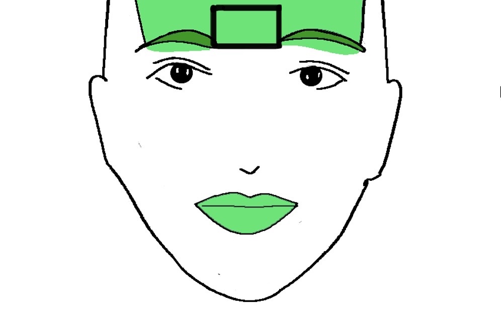 Botox- Glabella Complex