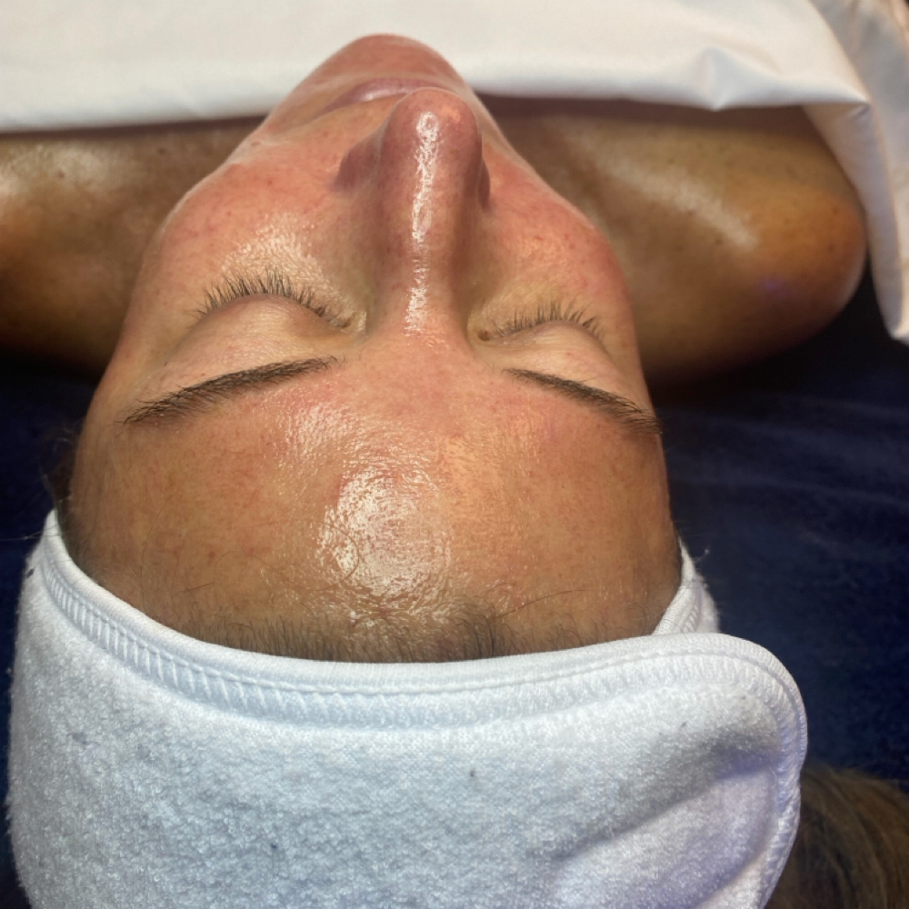 Deluxe Hydrafacial at Glam by Tam Aesthetics in Madison, WI