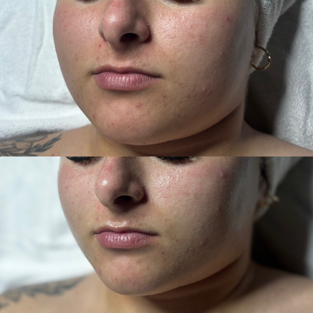 Anti-Aging Facial