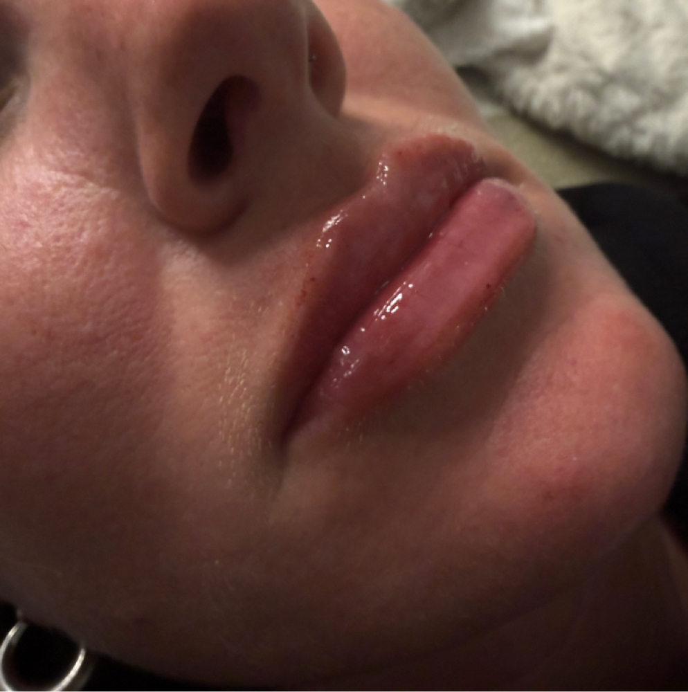 Mini Lips⟢ at InjectorFaiiry in Greenville, TX