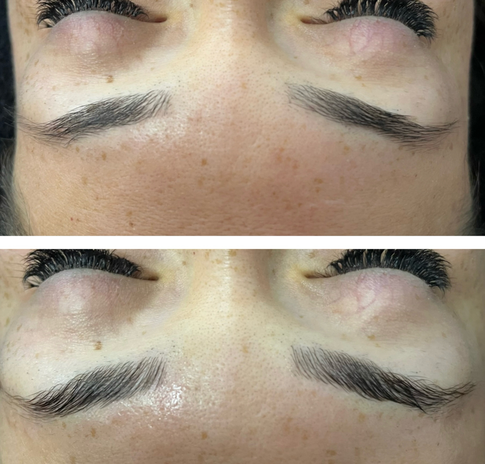 Brow Lamination