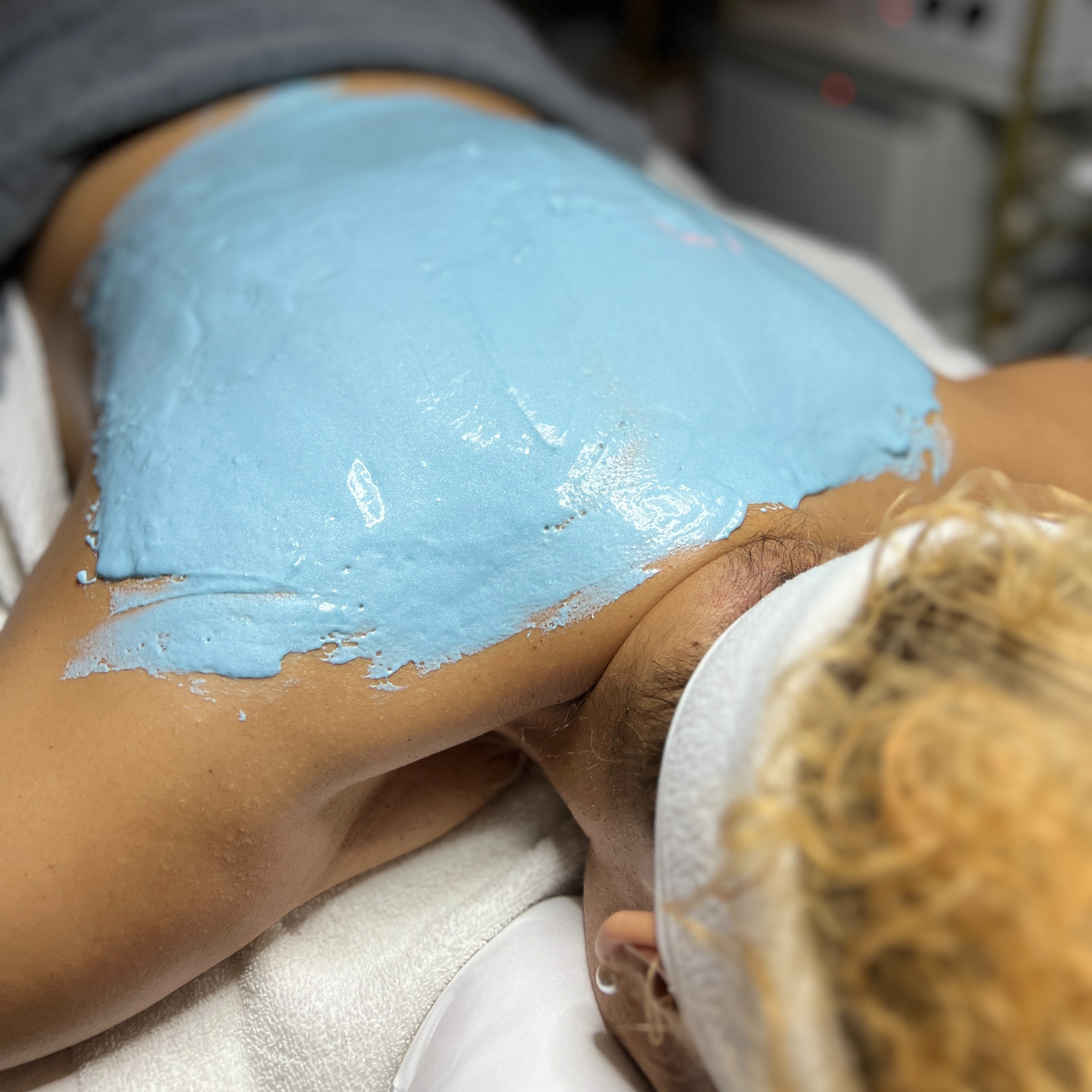 Back facial at Serenity Aesthetics by Denise in St. John’s, FL