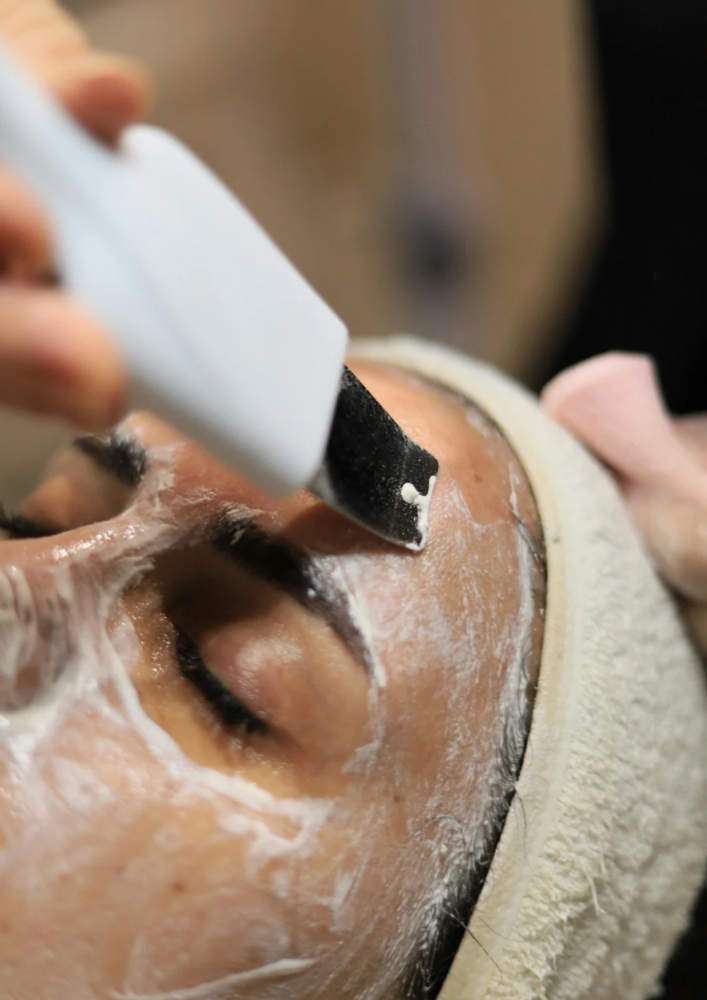 Advanced Peel