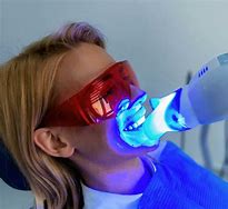 Teeth Whitening