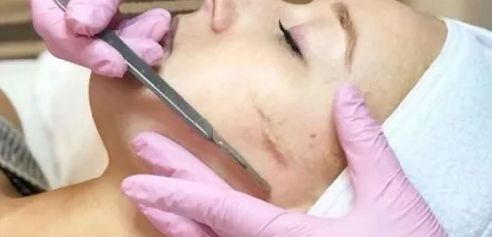 Dermaplane Treatment