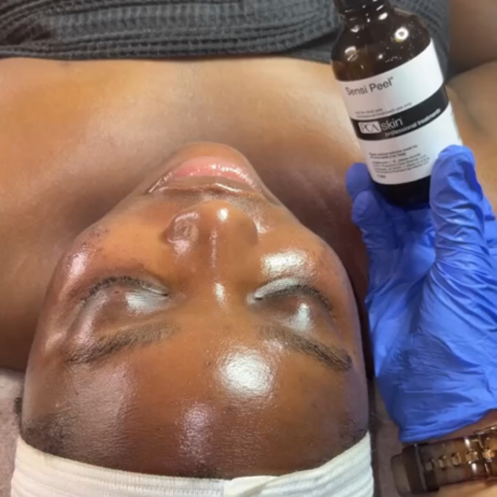 No Downtime Peel at Capital Complexion in Washington, DC