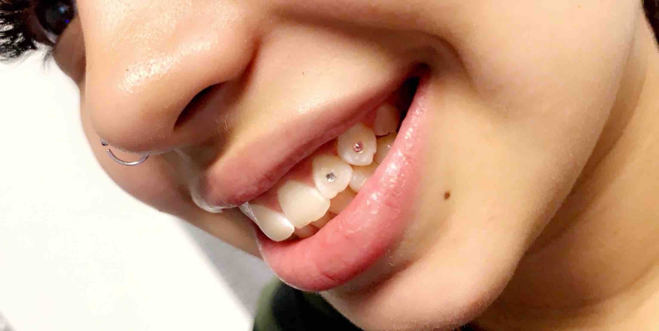 Tooth Gem 2 Teeth