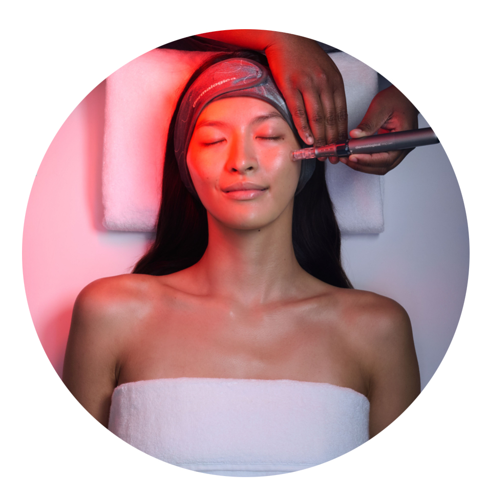 Collagen Induction Therapy