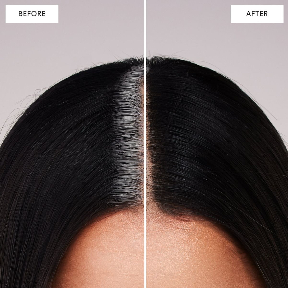 Roots Touch-Up