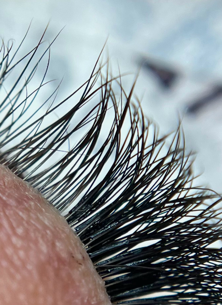 Removal of Eyelash Extensions